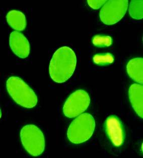 ANA sind Marker für Kollagenosen ANA = Anti-nukleäre (Zellkern) Antikörper richten sich gegen jede Zelle