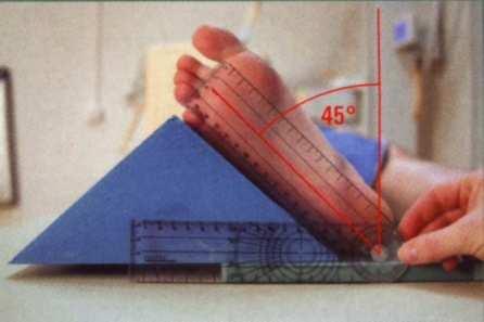 Step = Digital Diagnost (digitale Röntgenanlage Philips) 6 Patientenvorbereitung