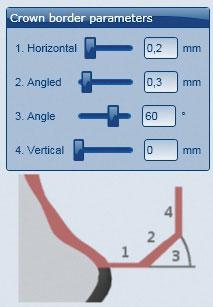 UTILIZARE Parametri pereţilor în software-ul CAD La Ceramill Zolid trebuie avut în vedere ca grosimea pereţilor să fie suficient de mare. Valori recomandate sunt: _ 1.