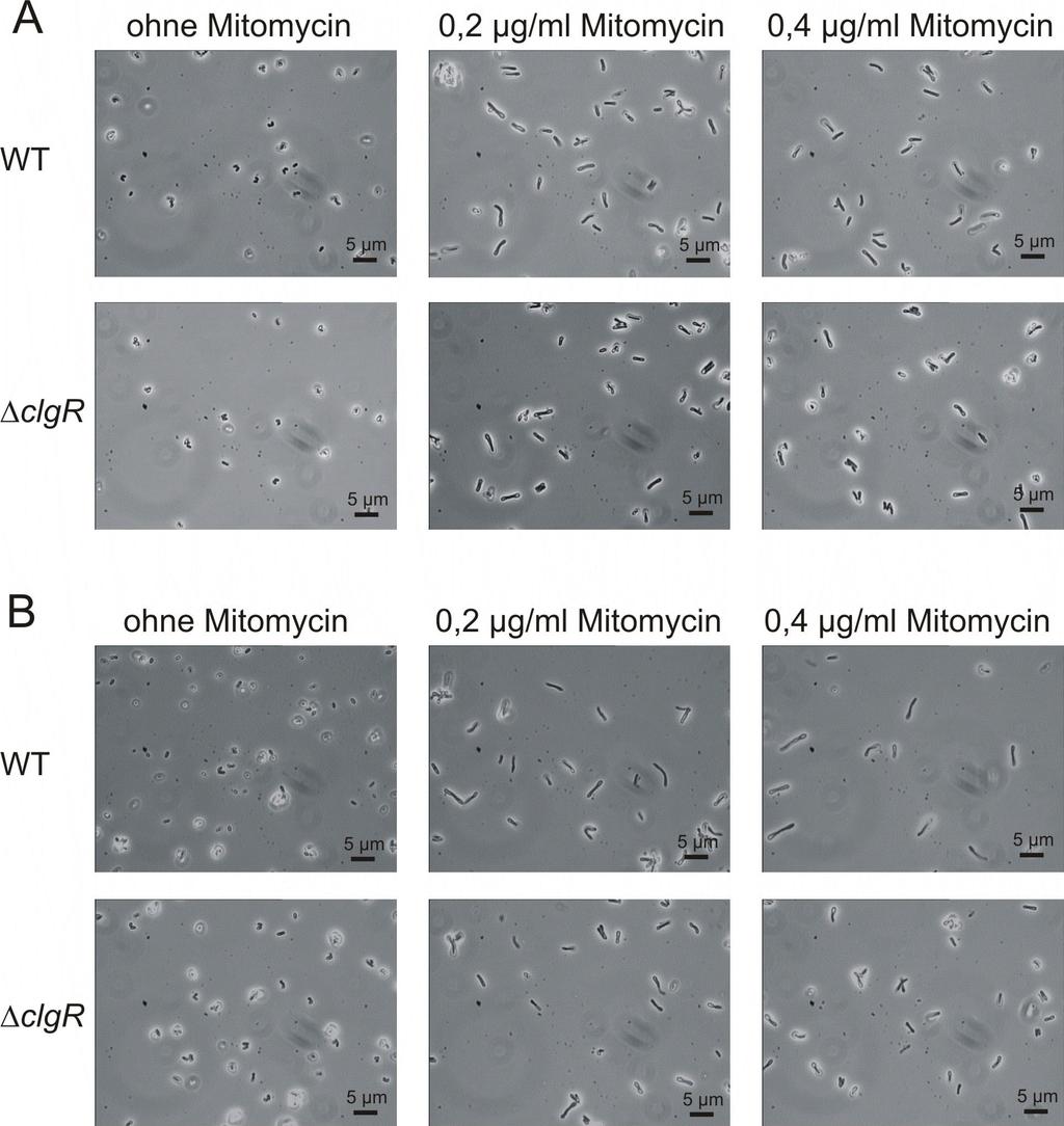Ergebnisse 83 Abb. 31: Lichtmikroskopische Aufnahmen von C. glutamicum ATCC13032 und clgr in Abwesenheit bzw. Anwesenheit verschiedener Mitomycin-Konzentrationen.
