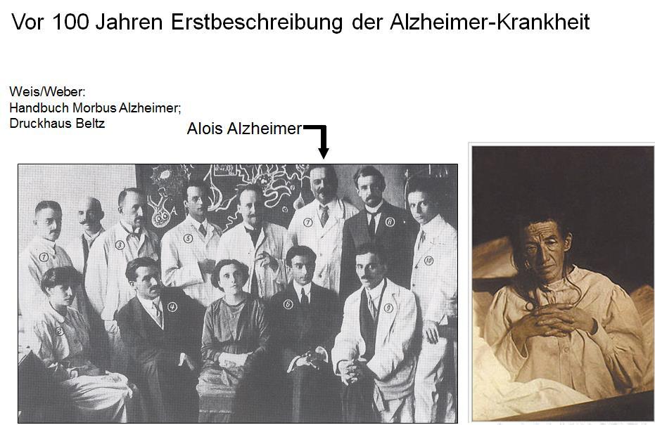 Alzheimer-Demenz Ein