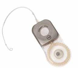 So funktioniert ein Cochlea-Implantat Das Cochlea-Implantat-System Ein Hörverlust entsteht in der Regel aufgrund eines Schadens im Innenohr oder der 3 Hörschnecke, dort also, wo der Klang an den