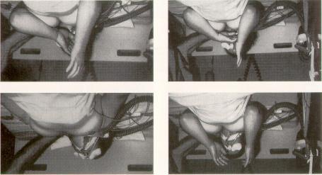 Spontanbewegungen eines Hirntoten Turmelet al 1991 Aufspaltung der Wahrnehmung Wahrnehmung von Lebenszeichen bei gleichzeitig vorliegenden Todeszeichen: Pflegepersonal, Ärzte, Transplanteure