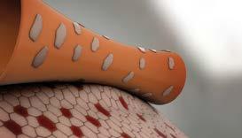 So wirkt die Safetac Technologie: Sie passt sich an die Vertiefungen der Hautoberfläche an Sie verklebt nicht mit der