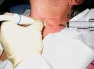 während einer Endoskopie) Punktionsbiopsien: Nadelbiopsie (mit