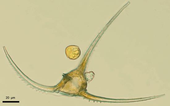 Rechts unten: Dinoflagellat