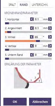 Teleskop-, Doppelkronen Werte der Parameter - Stumpfparameter, Innenpassung der Sekundärteile CoCr Typ4 Secondary Part Telescope Ti6Al4V Secondary Part Telescope Zementspalt Dicke 0,01 Start 1,00 End