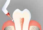 intensive und langanhaltende Fluoridierung Sofort desensibilisierend Transparent keine Verfärbungen auf den Zähnen Nur dünn aufzutragen, daher sehr ergiebig und wirtschaftlich