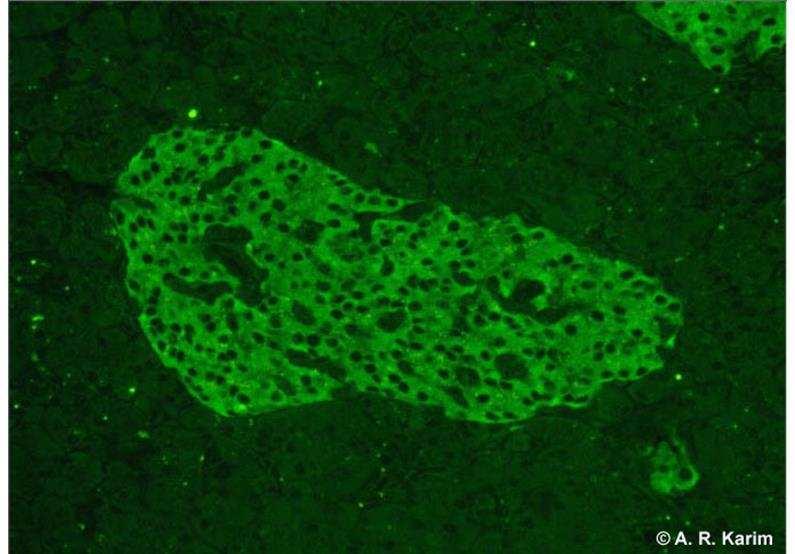 Inselzellantikörper