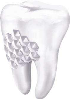 Schutzschicht wird auf den schmerzempfindlichen Bereichen der Zähne gebildet.