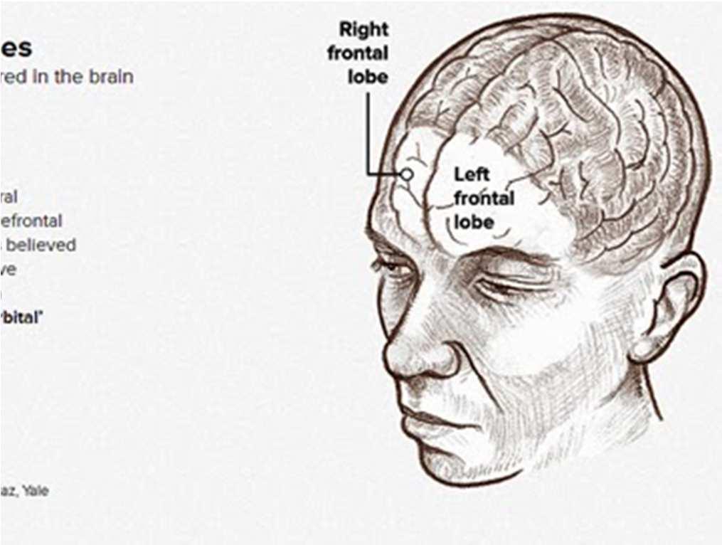 2. Geschichte der operativen Behandlung der Tourette