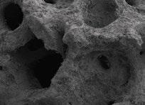 Hartgewebe Knochenersatzmaterialien cerabone Natürliches Knochenregenerations material bovinen s Bovin Boviner spongiöser Knochen von neuseeländischen Rindern cerabone bietet zuverlässige Stabilität