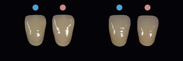 Zur besseren Farbnahme sollten daher auch mehrere parallel zueinander stehende Zahnmuster verwendet werden.