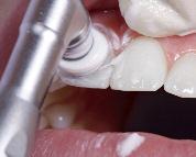 Zahnfleischerkrankungen dienen der Vermeidung von Zahnverlust und dem