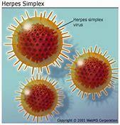 Herpes Labialis Der Auslöser: Herpes-Simplex-Virus Typ 1 Auslöser der Fieberblasen ist