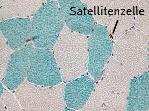 Die Satellitenzellen des Muskelgewebes werden Myoblasten genannt und sind Vorläuferzellen der späteren Muskelfasern. Myoblasten enthalten einen Zellkern.