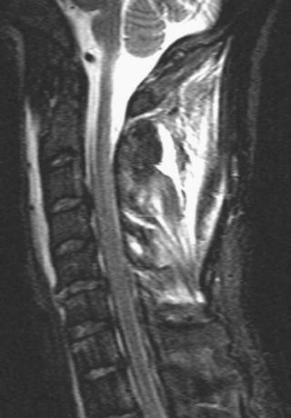 Naidich et al, Imaging of