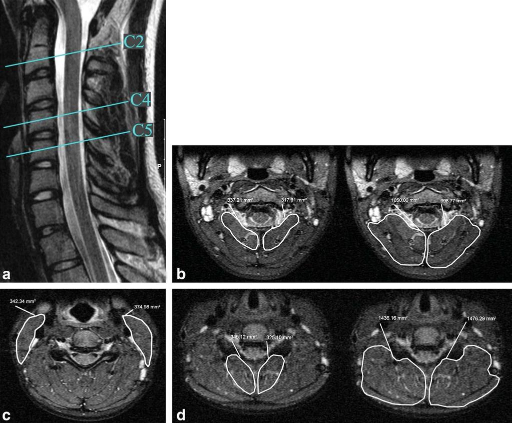 Ulbrich et al, Journal