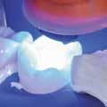 4-MET MDP MDTP Zahnschmelz und Dentin Zahnschmelz, Dentin, Composite- und Nichtedelmetallaufbauten Edelmetallen Klar verständlicher