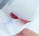 Im Gegensatz zur konventionellen ISO-Messmethode, bei der das Inkontinenzprodukt vollständig in eine Urinersatzlösung getaucht wird, werden bei der ABL-Testmethode die