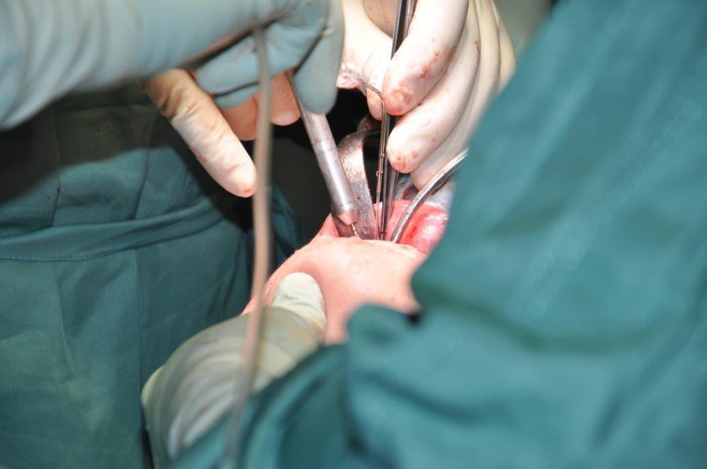 Durchführung der OP Doku Ausfüllen des Implantat-Passes und nachfüllen der