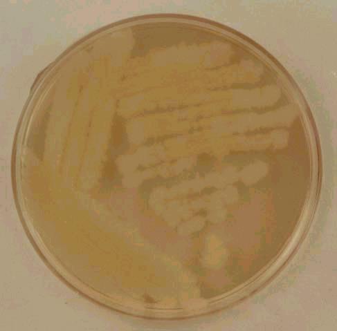 23. Bacillus cereus auf