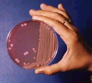 Bakterium mit lila Kolonien zb.: E.