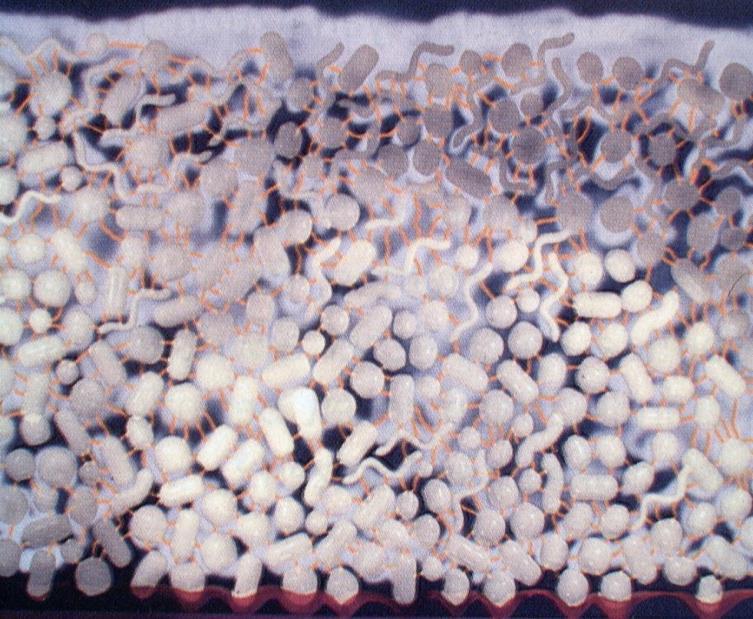 Mikroorganismen - Biofilme schleimhautbesiedelnde Keime koronale Plaque marginale Plaque subgingivale Plaque Plaque - Biofilme Einlagerung von abgestorbenen zellulären Bestandteilen (Epithelzellen,