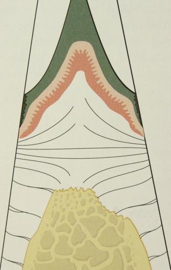 Okklusion und Parodont Infiltriertes Bindegewebe Saumepithel Fundus