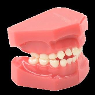 Human Dental - Modelle 22 Modell der Zahnkrankheiten