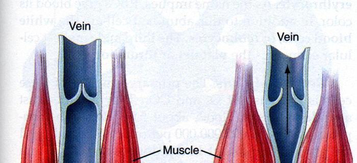 Die venöse Klappen helfen der Muskelpumpe Varikosität Vene