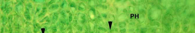 Abb. 4: Grenze Xylem (XY) zum jüngsten Phloem (PH), im Zentrum des Einstichs. Querschnitt, Toluidinblau. Pfeilspitzen = Kambium. Fig.