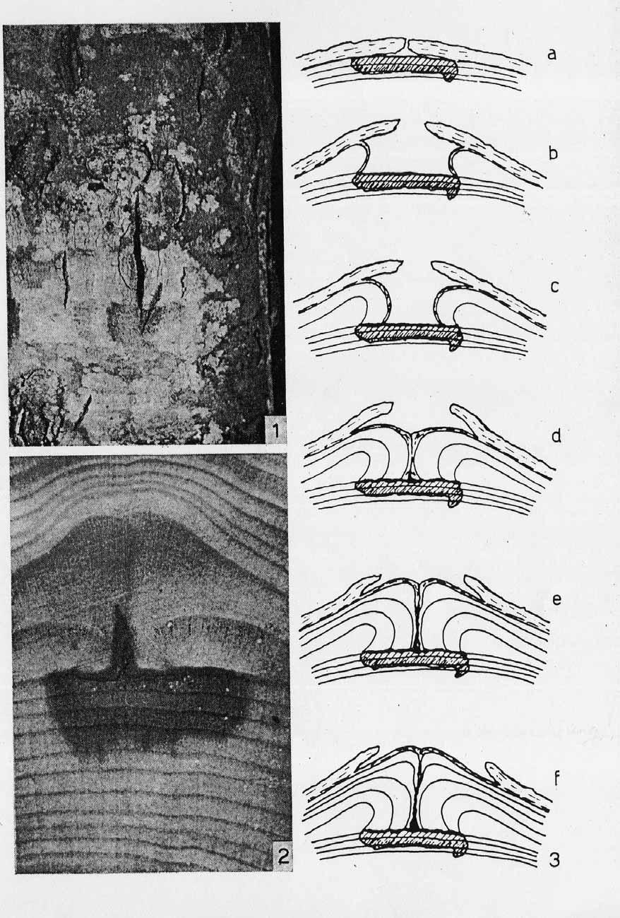 Abb. 18: (aus BOSSHARD, 1965, Abb. 1-3 eingescannt). Buchenrinde mit Haarriss und Überwallung des Haarrisses.
