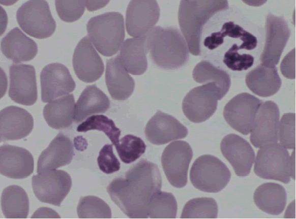 Babesiose 70 Anaplasma phagocytophilum Morula