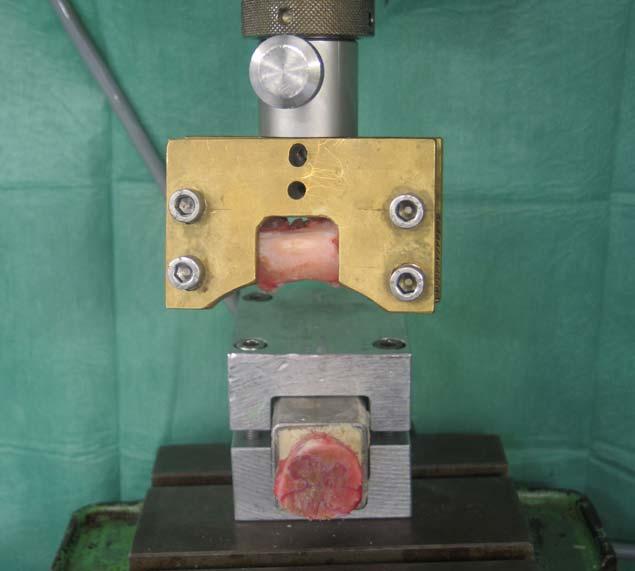 Material und Methoden Die Gewebehalterung mit dem Claviculaknochen konnte nun in horizontaler Ausrichtung direkt mit der Kraftmesszelle der Materialtestmaschine verbunden werden. Der den Proc.