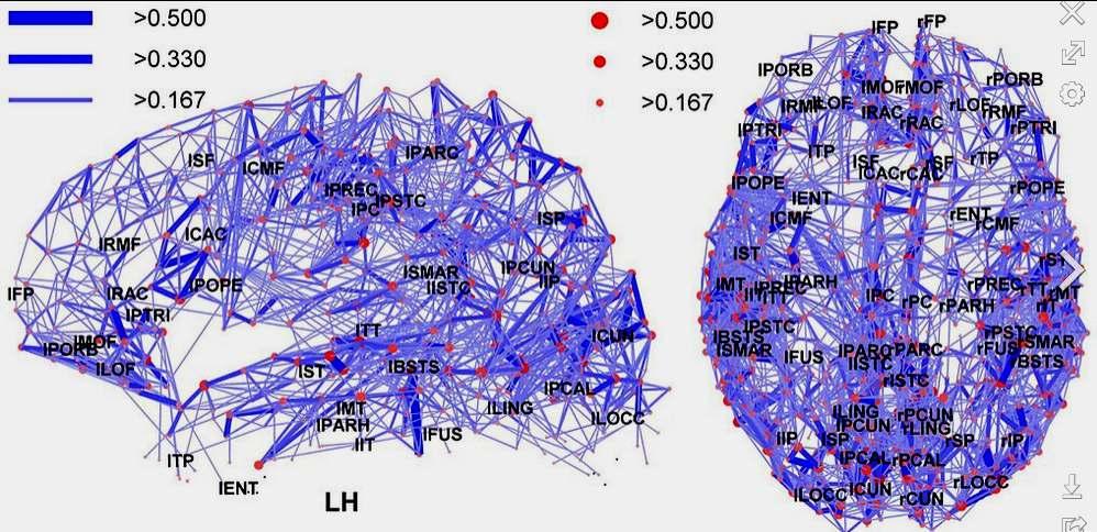 Konnektom-Modell: Menschliche Großhirnrinde Cortico-corticale Asssoziations- und Kommissurfasern