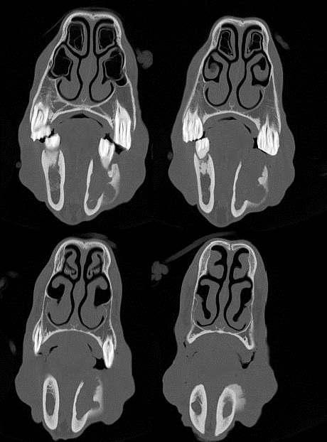 Computertomographische US: Tumor der zahnschmelzbildenden Zellen