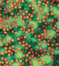 Was bedeutet «Surrogatvirus» im Zusammenhang mit dem Norovirus?