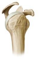 humeri), dem beweglichsten aber auch anfälligsten Gelenk des Körpers, artikulieren das Caput humeri und die Cavitas glenoidalis der Scapula in Form eines Kugelgelenks.