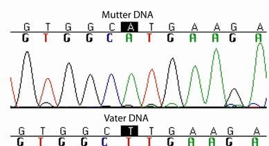 Ergebnisse aus Blutproben der Eltern wurde hinsichtlich des SNPs (single nucleotide polymorphism) rs12908526 (A/T) im Exon 26 von PWRN1 genotypisiert.