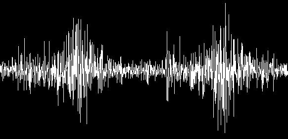 Die lokalen Potentialdifferenzen können von Elektroden an der Hautoberfläche aufgezeichnet werden und dienen als Diagnostikum bei der Bewertung des