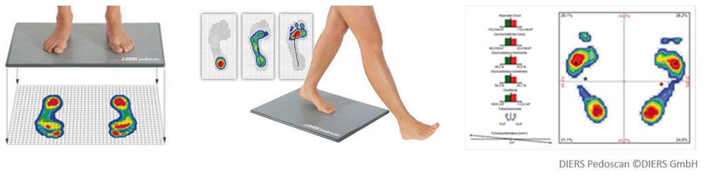 , Statische und dynamische Fußdruckmessung Die Fußdruckmessung und die Ganganalyse ermöglichen eine schnelle und präzise Erfassung und Darstellung der Druckverhältnisse des menschlichen Fußes, sowohl