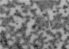 Abb. 1: RG1-VLP: hocheffiziente Bildung von Virusähnlichen Partikeln. Umwelteinflüsse.