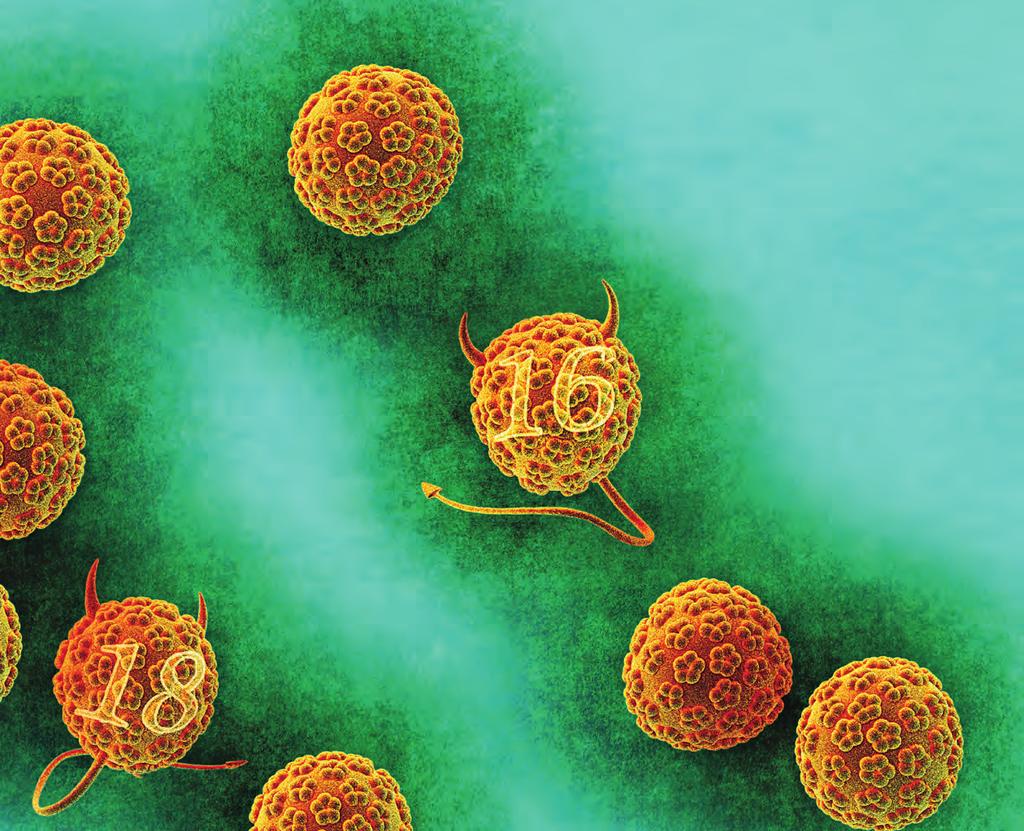 Der cobas HPV Test RISIKEN ERKENNEN Zervixkarzinom-Vorsorge Der Teufel steckt im Detail Mit dem cobas HPV Test
