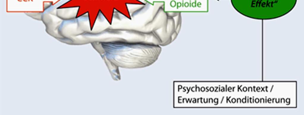 Opioid-Antagonist vermindert den Placebo-Effekt