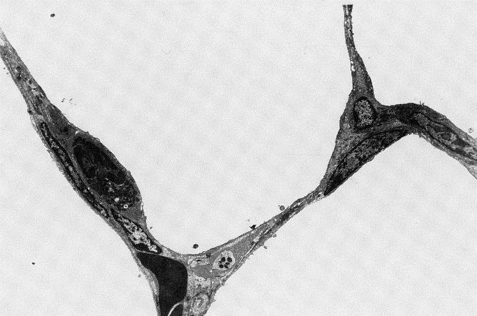Die Lunge des neugeborenen Kalbes Morphologisch: Grundstruktur einer vollständig entwickelten Lunge Anzahl an Alveolen: 5-10 x 10 9 (= 120-150 m² Alveolaroberfläche) Castleman & Lay, Am. J. Vet. Res.