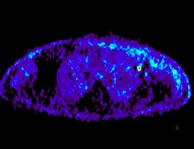 PET-CT-Untersuchungen: Positron Emission Tomography (PET) FDG-Untersuchungen NON-FDG-Untersuchungen