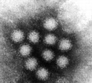 Verursacher von Durchfall bei Säuglingen Noroviren