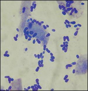 Infektiöse Otitis externa: Malassezien Polypharma-Fungizide: Resistenzen