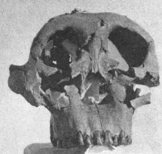 Die robusten Australopithecinen